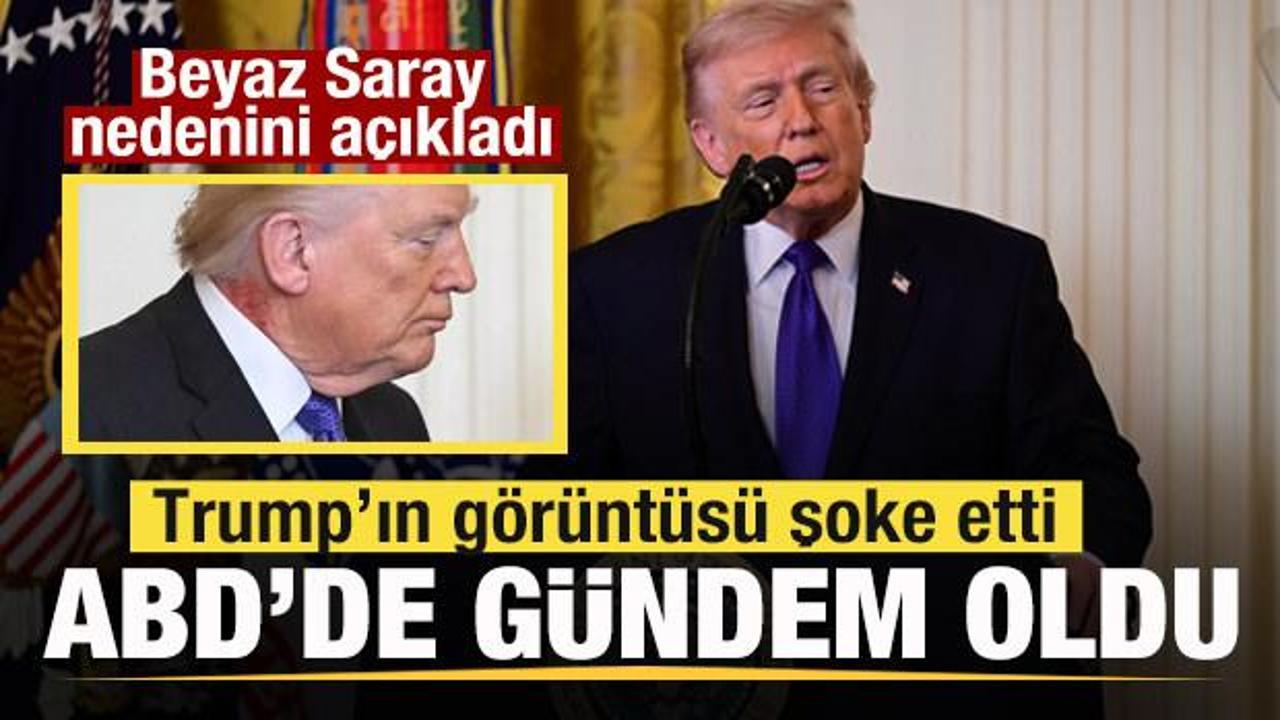 Trump'ın görüntüsü şoke etti! ABD'de gündem oldu! Beyaz Saray nedenini açıkladı