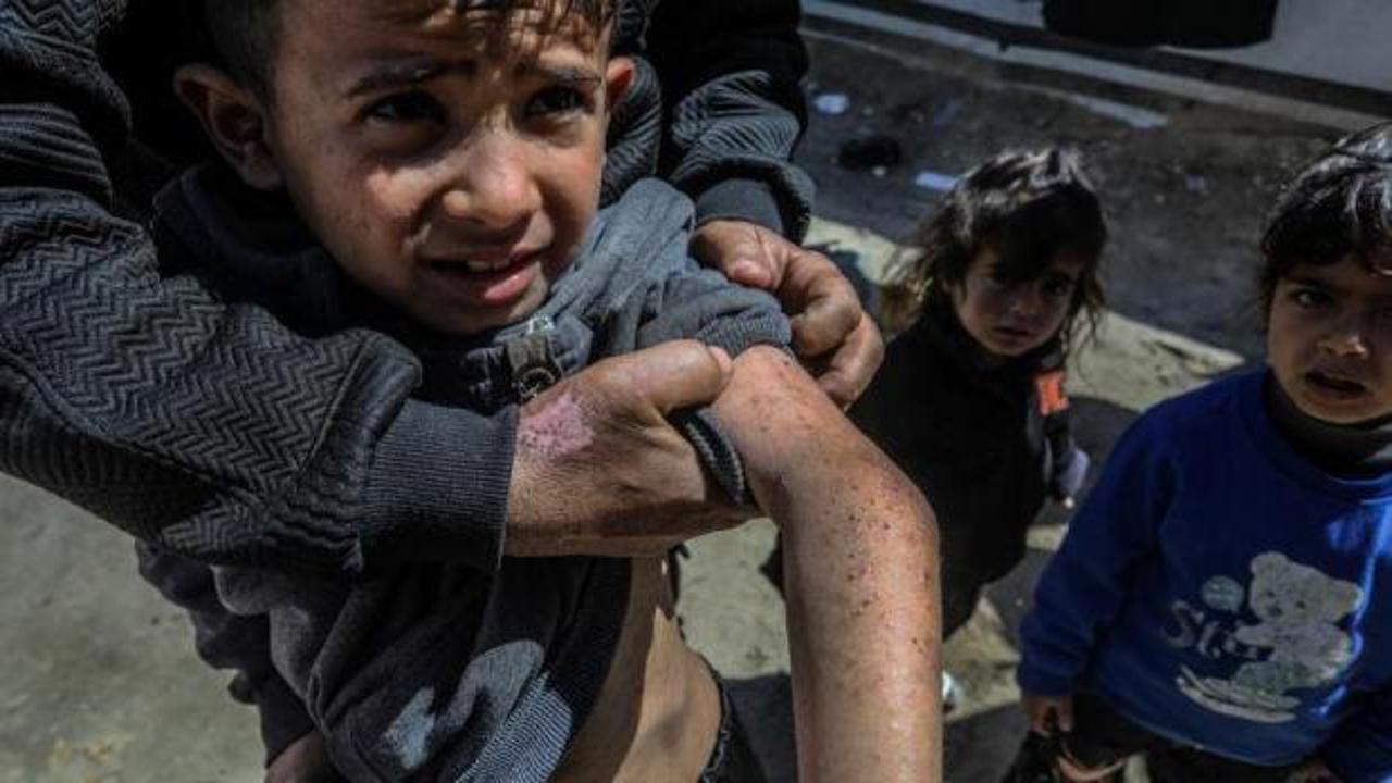 Gazze'de salgın uyarısı: Sağlık bakanlığından DSÖ'ye çağrı